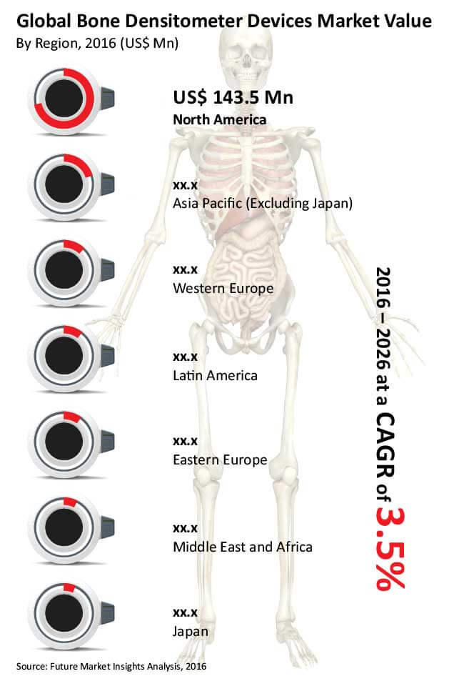 bone densitometer devices market_image for preview analysis